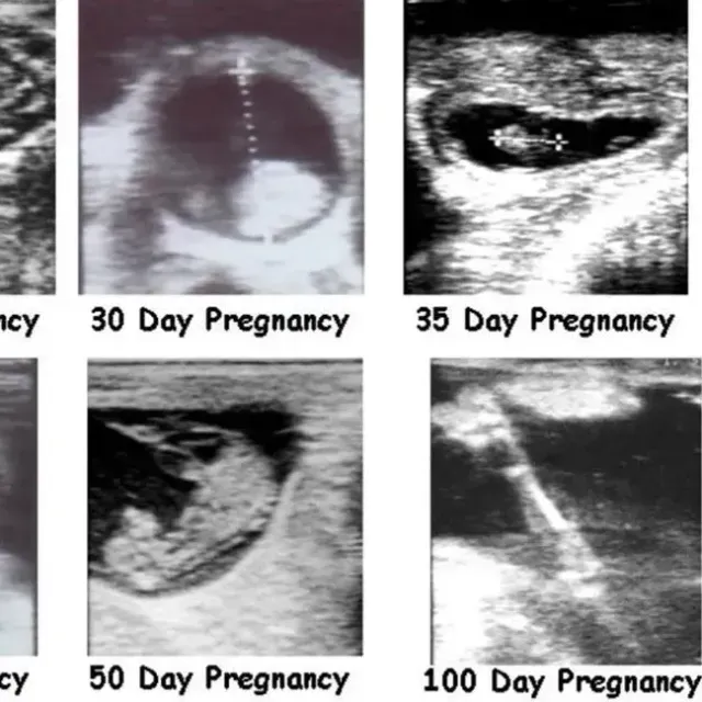 thumbnail for publication: Practical Uses for Ultrasound in Managing Beef Cattle Reproduction